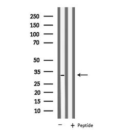 Invitrogen KCNK6 Polyclonal Antibody 100 μL; Unconjugated:Antibodies,