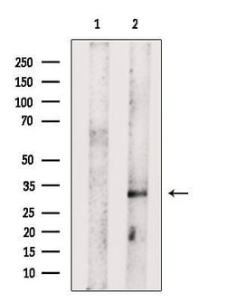 Invitrogen KCNK6 Polyclonal Antibody 100 μL; Unconjugated:Antibodies,