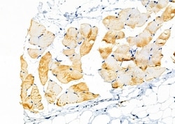 Invitrogen KCNK7 Polyclonal Antibody 100 &mu;L; Unconjugated:Antibodies,
