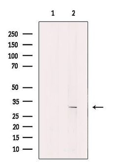 Invitrogen KCNK7 Polyclonal Antibody 100 &mu;L; Unconjugated:Antibodies,