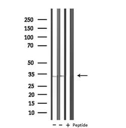 Invitrogen KCNK7 Polyclonal Antibody 100 &mu;L; Unconjugated:Antibodies,