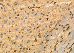 Invitrogen KCNH3 Polyclonal Antibody 100 &mu;L; Unconjugated:Antibodies,