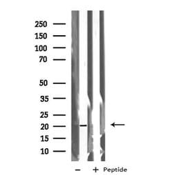 Invitrogen BTC Polyclonal Antibody 100 &mu;L | Buy Online | Invitrogen&trade; | Fisher Scientific