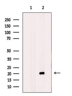 Invitrogen BTC Polyclonal Antibody 100 &mu;L | Buy Online | Invitrogen&trade; | Fisher Scientific