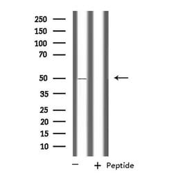 Invitrogen PPM1L Polyclonal Antibody 100 &mu;L; Unconjugated:Antibodies,