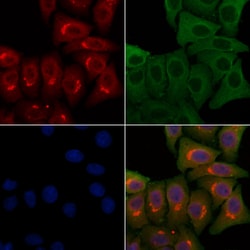 Invitrogen PMS2/PMS2CL Polyclonal Antibody 100 &mu;L; Unconjugated:Antibodies,