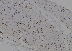 Invitrogen PMS2/PMS2CL Polyclonal Antibody 100 &mu;L; Unconjugated:Antibodies,