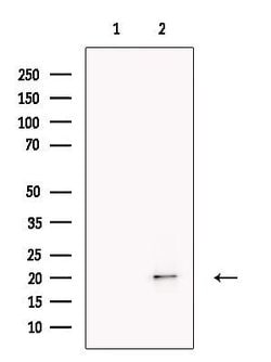 Invitrogen PMS2/PMS2CL Polyclonal Antibody 100 &mu;L; Unconjugated:Antibodies,