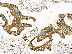 Invitrogen MOV10L1 Polyclonal Antibody 100 &mu;L; Unconjugated:Antibodies,