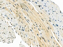 Invitrogen PDK1 Polyclonal Antibody 100 &mu;L; Unconjugated:Antibodies,