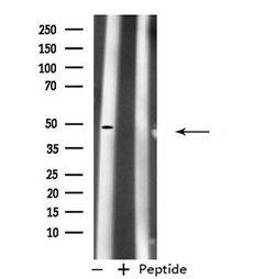Invitrogen PDK1 Polyclonal Antibody 100 &mu;L; Unconjugated:Antibodies,