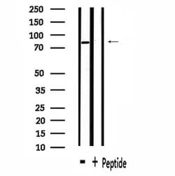 Invitrogen ZFYVE20/Rabenosyn 5 Polyclonal Antibody 100 &mu;L; Unconjugated:Antibodies,