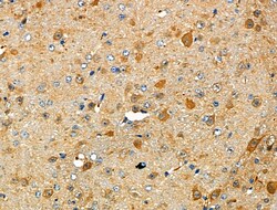Invitrogen RAP1GAP Polyclonal Antibody 100 μL; Unconjugated:Antibodies,