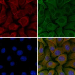 Invitrogen RAB26 Polyclonal Antibody 100 &mu;L; Unconjugated:Antibodies,