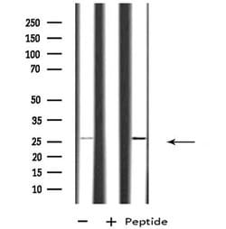 Invitrogen RAB26 Polyclonal Antibody 100 &mu;L; Unconjugated:Antibodies,