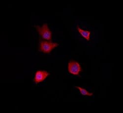 Invitrogen RAB38 Polyclonal Antibody 100 &mu;L; Unconjugated:Antibodies,