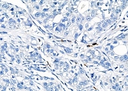 Invitrogen RAB38 Polyclonal Antibody 100 &mu;L; Unconjugated:Antibodies,
