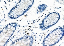 Invitrogen RAB38 Polyclonal Antibody 100 &mu;L; Unconjugated:Antibodies,
