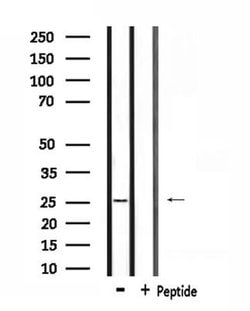 Invitrogen RAB38 Polyclonal Antibody 100 &mu;L; Unconjugated:Antibodies,