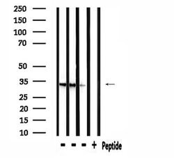 Invitrogen RAB40B Polyclonal Antibody 100 &mu;L; Unconjugated:Antibodies,