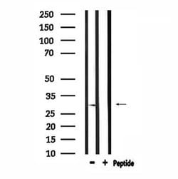 Invitrogen RAB29 Polyclonal Antibody 100 &mu;L; Unconjugated:Antibodies,