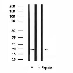 Invitrogen RGS10 Polyclonal Antibody 100 μL; Unconjugated:Antibodies,