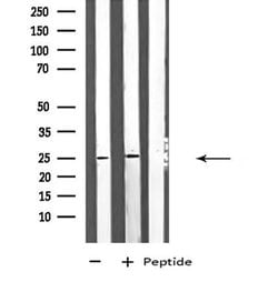 Invitrogen ARHGDIG Polyclonal Antibody 100 &mu;L; Unconjugated:Antibodies,
