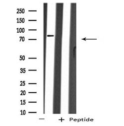 Invitrogen ARHGEF16 Polyclonal Antibody 100 &mu;L; Unconjugated:Antibodies,
