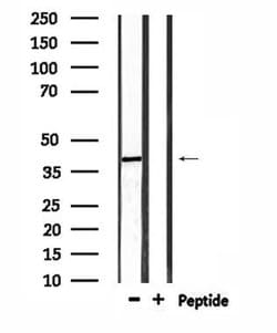Invitrogen RRS1 Polyclonal Antibody 100 &mu;L | Buy Online | Invitrogen&trade; | Fisher Scientific