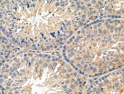 Invitrogen SFRP2 Polyclonal Antibody 100 &mu;L; Unconjugated:Antibodies,