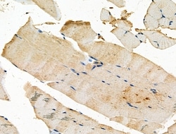 Invitrogen SFRP2 Polyclonal Antibody 100 &mu;L; Unconjugated:Antibodies,
