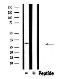 Invitrogen SFRP2 Polyclonal Antibody 100 &mu;L; Unconjugated:Antibodies,