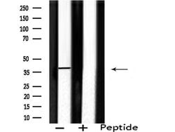 Invitrogen SEPT2 Polyclonal Antibody 100 &mu;L; Unconjugated:Antibodies,