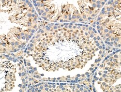 Invitrogen STK32C Polyclonal Antibody 100 &mu;L; Unconjugated:Antibodies,