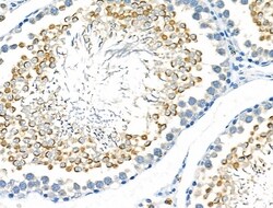 Invitrogen STK32C Polyclonal Antibody 100 &mu;L; Unconjugated:Antibodies,