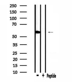 Invitrogen STK32C Polyclonal Antibody 100 &mu;L; Unconjugated:Antibodies,