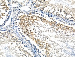 Invitrogen STK36 Polyclonal Antibody 100 &mu;L; Unconjugated:Antibodies,