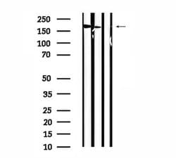 Invitrogen STK36 Polyclonal Antibody 100 &mu;L; Unconjugated:Antibodies,
