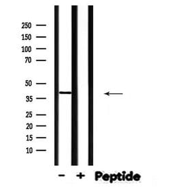 Invitrogen STK36 Polyclonal Antibody 100 &mu;L; Unconjugated:Antibodies,