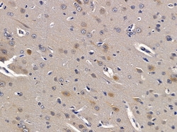 Invitrogen NIM1 Polyclonal Antibody 100 &mu;L; Unconjugated:Antibodies,