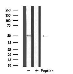 Invitrogen NIM1 Polyclonal Antibody 100 &mu;L; Unconjugated:Antibodies,