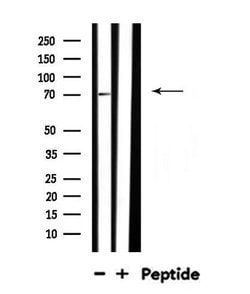 Invitrogen PLK3 Polyclonal Antibody 100 &mu;L; Unconjugated:Antibodies,