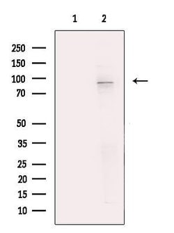 Invitrogen TNNI3K Polyclonal Antibody 100 &mu;L | Buy Online | Invitrogen&trade; | Fisher Scientific