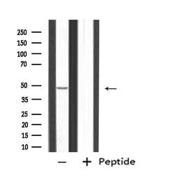 Invitrogen PPP2R2B Polyclonal Antibody 100 &mu;L; Unconjugated:Antibodies,