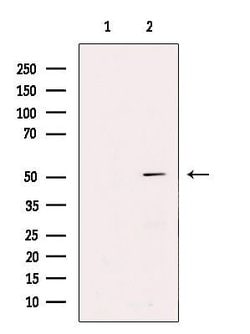 Invitrogen PPP2R2B Polyclonal Antibody 100 &mu;L; Unconjugated:Antibodies,