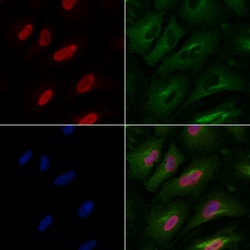 Invitrogen PPP2R5A Polyclonal Antibody 100 &mu;L; Unconjugated:Antibodies,