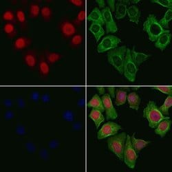 Invitrogen PPP2R5A Polyclonal Antibody 100 &mu;L; Unconjugated:Antibodies,