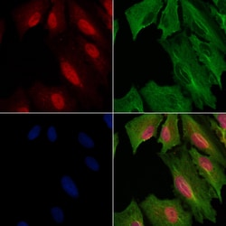 Invitrogen PPP4R1L Polyclonal Antibody 100 &mu;L; Unconjugated:Antibodies,