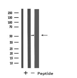 Invitrogen PPP4R1L Polyclonal Antibody 100 &mu;L; Unconjugated:Antibodies,