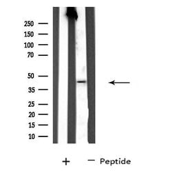 Invitrogen SERPINA11 Polyclonal Antibody 100 μL; Unconjugated:Antibodies,